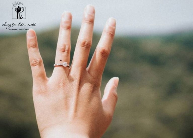 Giải mã nốt ruồi trên ngón tay đeo nhẫn cưới: May mắn hay xui rủi?
